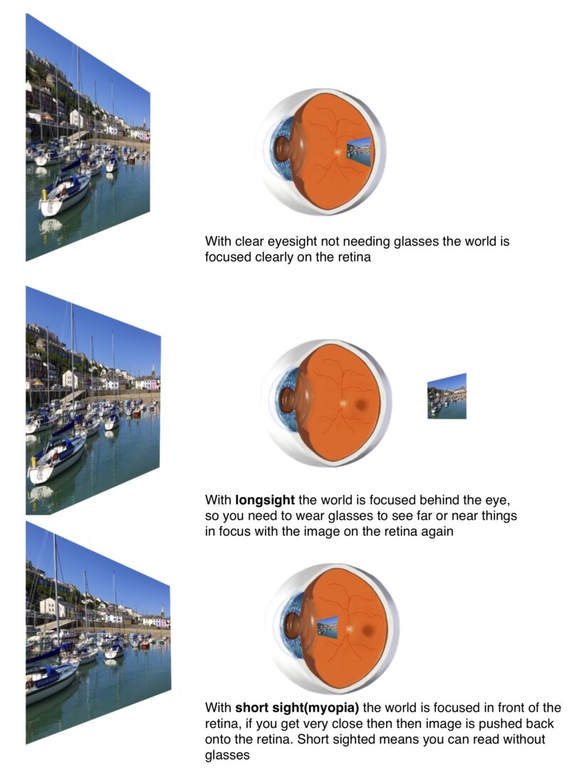 Eyesight explained - Dr Ray Radford